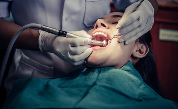 Tratamiento de la endodoncia en Asturias