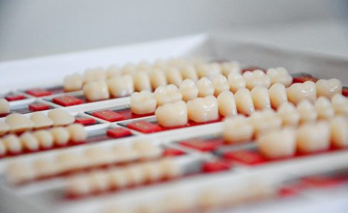 Muestras de color en dientes para implantes dentales